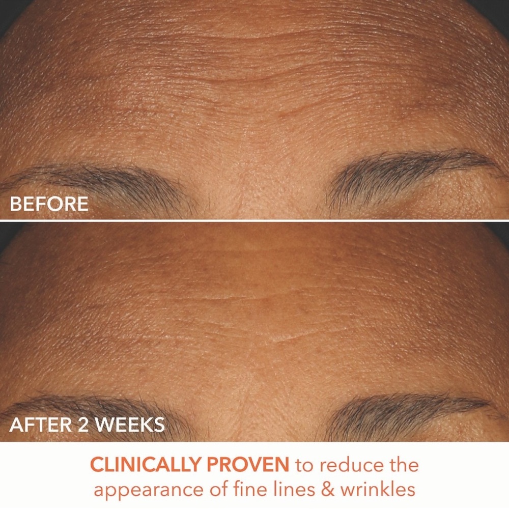 3 for $30-Dr Dennis Gross Alpha Beta Extra Strength Daily Peel Pads - Picture 9 of 16